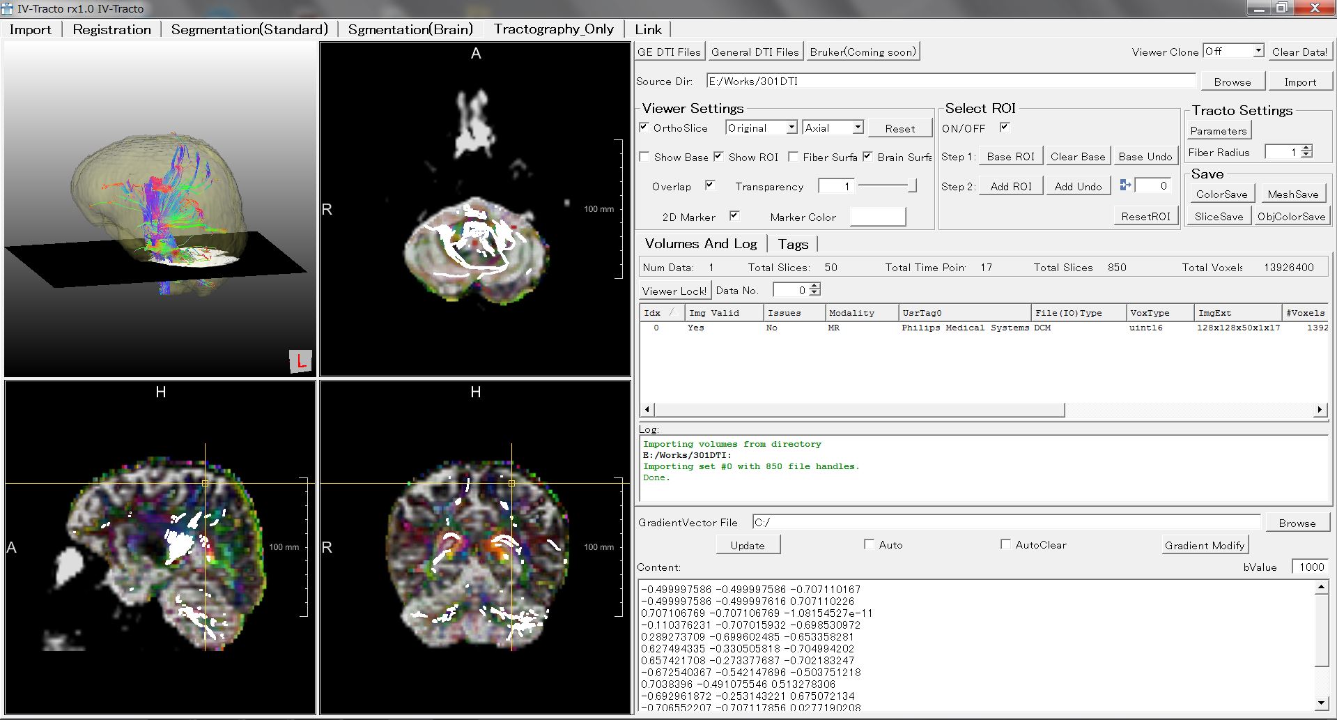 Tractography